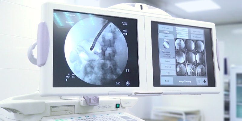 内窥镜检查是一种结合超声和内窥镜检查功能的诊断技术。 对于使用带摄像机和超声波传感器的柔性内窥镜进行研究。 它可以插入食道，胃，十二指肠溃疡，直肠，大肠，进入呼吸道。