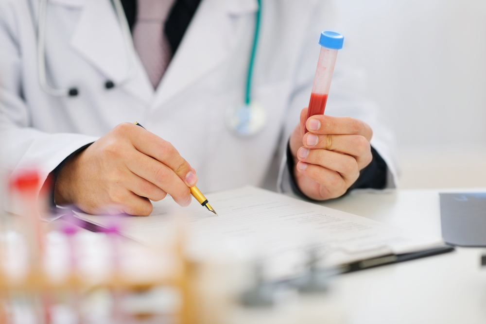 En standard biokjemisk blodprøve inkluderer et antall indikatorer som tas med i aggregatet